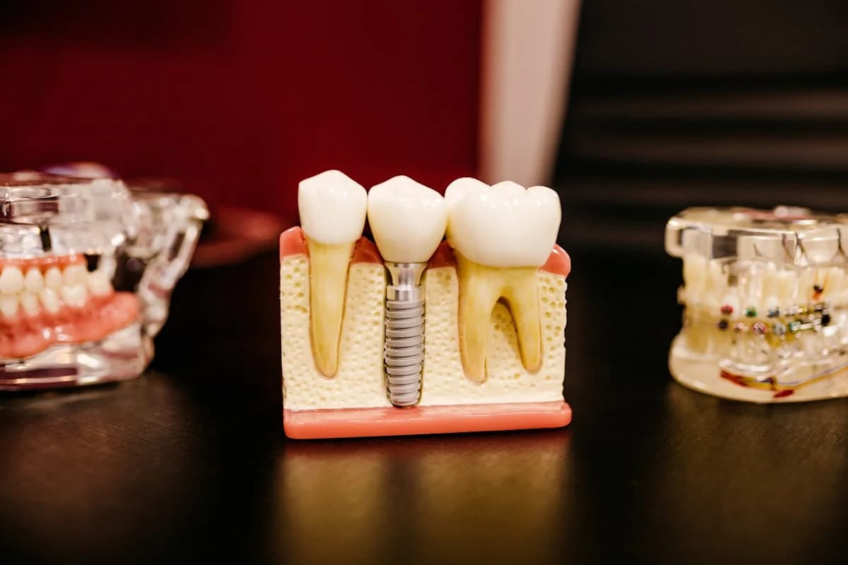 Implantati